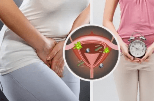What is cystitis