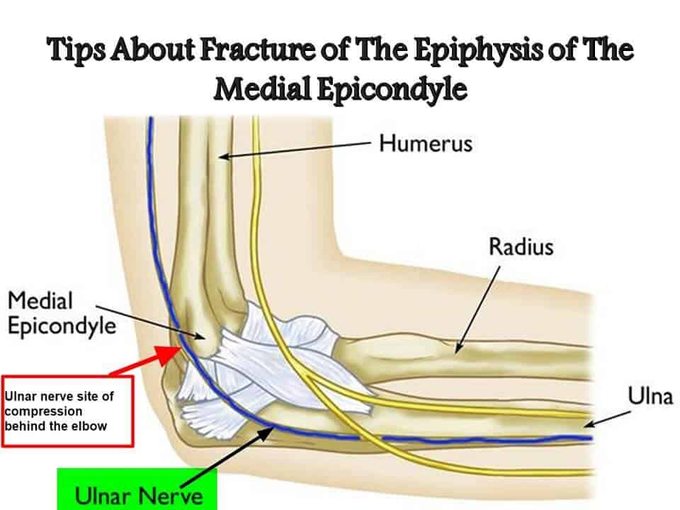 Epiphysis of The Medial Epicondyle