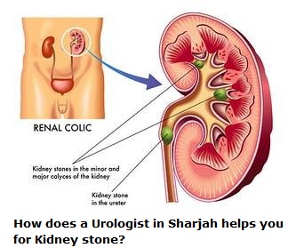 How does a Urologist in Sharjah helps you for Kidney stone