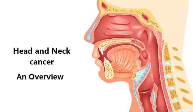 Head and Neck Cancer - an Overview